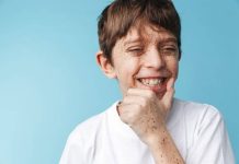 Rüyada Çil Görmek Ne Anlama Gelir? Rüyada çil görmek. Rüyada yüzünde çiller görmek. Rüyada yüzü çilli birini görmek.