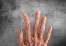 Rüyada Cüzzam Görmek Ne Anlama Gelir? Rüyada cüzzam olduğunu görmek. Rüyada cüzzam hastalığı görmek. Rüyada cüzzamlı birini görmek.