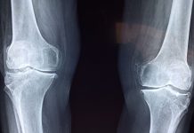 Rüyada Kemik Görmek Ne Anlama Gelir? Rüyada kemik görmek, rüyada bir kemik kırıldığını duymak, rüyada kemiklerin bir araya gelmesi, rüyada kemik bulmak ve rüyada kemik yığını görmek.
