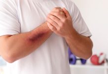 Rüyada Morluk Görmek Ne Anlama Gelir? Rüyada vücutta morluk olduğunu görmek, rüyada morluğun izini görmek, rüyada morluk nedeniyle rahatsızlık hissetmek ve rüyada morluklar tedavi edilmek.