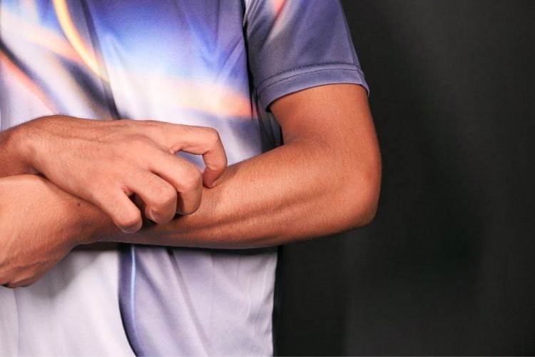 Sıcak döküntüsü ile egzama, kurdeşen gibi diğer kaşıntılı cilt sorunları arasındaki farkları gösteren tablo
